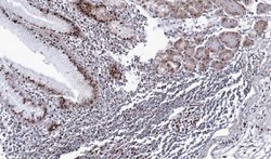 Invitrogen DDX39 Polyclonal Antibody 100 μL; Unconjugated:Antibodies,