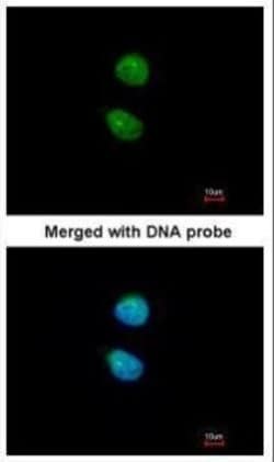 ZNF306 Polyclonal Antibody:Antibodies, Polyclonal