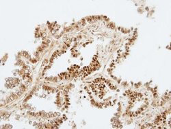 ZNF306 Polyclonal Antibody:Antibodies, Polyclonal