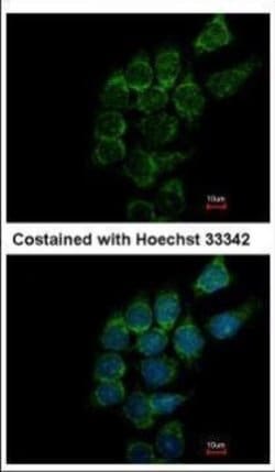 Invitrogen ST3GAL1 Polyclonal Antibody 100 &mu;L; Unconjugated:Antibodies,