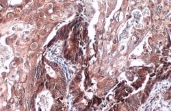 Invitrogen ST3GAL1 Polyclonal Antibody 100 &mu;L; Unconjugated:Antibodies,