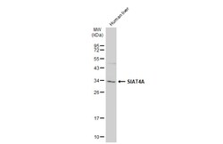 Invitrogen ST3GAL1 Polyclonal Antibody 100 &mu;L; Unconjugated:Antibodies,