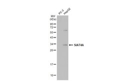 Invitrogen ST3GAL1 Polyclonal Antibody 100 &mu;L; Unconjugated:Antibodies,