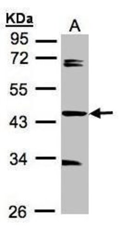 Invitrogen SDCCAG3 Isoform 1 Polyclonal Antibody 100 &mu;L; Unconjugated:Antibodies,