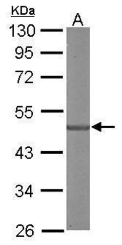 Invitrogen SDCCAG3 Isoform 1 Polyclonal Antibody 100 &mu;L; Unconjugated:Antibodies,