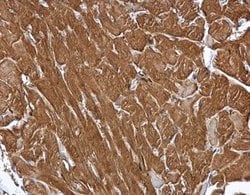 Invitrogen MINPP1 Polyclonal Antibody 100 &mu;L; Unconjugated:Antibodies,