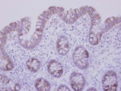 CCDC83 Polyclonal Antibody:Antibodies, Polyclonal