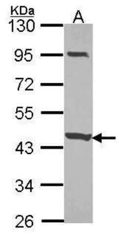 CCDC83 Polyclonal Antibody:Antibodies, Polyclonal