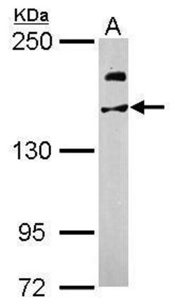 Invitrogen USP47 Polyclonal Antibody 100 &mu;L; Unconjugated:Antibodies,