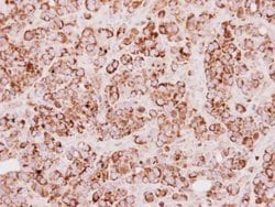 Invitrogen TST Polyclonal Antibody 100 &mu;L; Unconjugated:Antibodies,