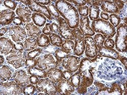 Invitrogen TST Polyclonal Antibody 100 &mu;L; Unconjugated:Antibodies,