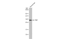 Invitrogen TST Polyclonal Antibody 100 &mu;L; Unconjugated:Antibodies,
