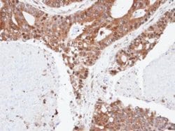 ERLIN2 Polyclonal Antibody:Antibodies, Polyclonal