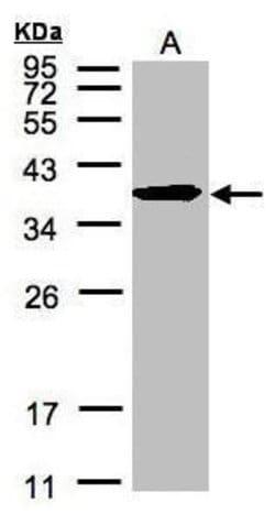 ERLIN2 Polyclonal Antibody:Antibodies, Polyclonal