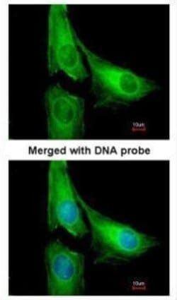Invitrogen AGAP1 Polyclonal Antibody 100 &mu;L; Unconjugated:Antibodies,
