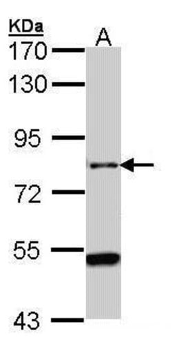 Invitrogen AGAP1 Polyclonal Antibody 100 &mu;L; Unconjugated:Antibodies,
