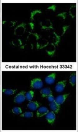 Invitrogen CMG1 Polyclonal Antibody 100 &mu;L; Unconjugated:Antibodies,
