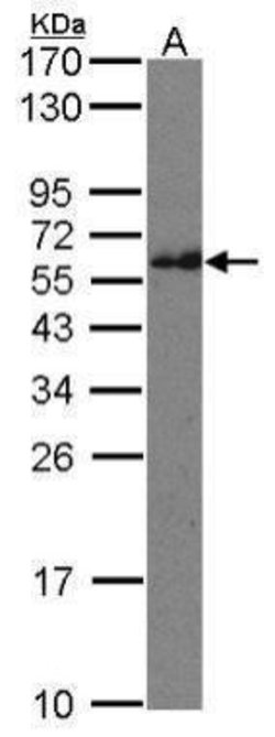 Invitrogen CMG1 Polyclonal Antibody 100 &mu;L; Unconjugated:Antibodies,
