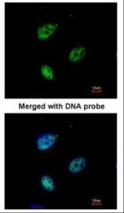 Invitrogen KPNA4 Polyclonal Antibody 100 &mu;L; Unconjugated:Antibodies,