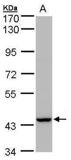 Invitrogen PEX13 Polyclonal Antibody 100 μL; Unconjugated:Antibodies,