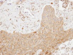 Invitrogen SKAP2 Polyclonal Antibody 100 &mu;L | Buy Online | Invitrogen&trade; | Fisher Scientific