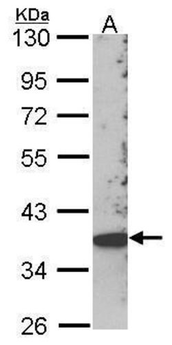 Invitrogen SKAP2 Polyclonal Antibody 100 &mu;L | Buy Online | Invitrogen&trade; | Fisher Scientific