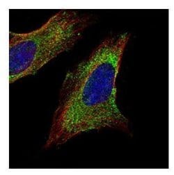 Invitrogen&trade;&nbsp;TOM1L1 Polyclonal Antibody