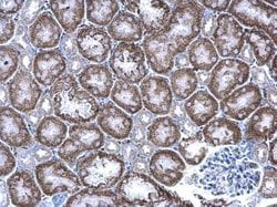 Invitrogen GIPC1 Polyclonal Antibody 100 &mu;L; Unconjugated:Antibodies,