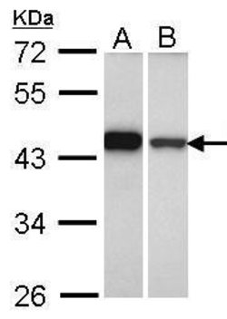 Invitrogen GIPC1 Polyclonal Antibody 100 &mu;L; Unconjugated:Antibodies,