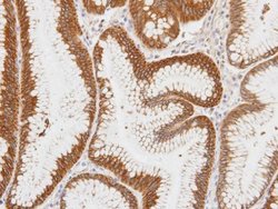 Centaurin alpha-1 Polyclonal Antibody:Antibodies, Polyclonal