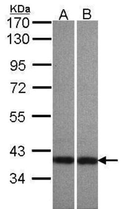 Centaurin alpha-1 Polyclonal Antibody:Antibodies, Polyclonal