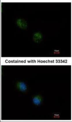 Invitrogen STMN2 Polyclonal Antibody 100 &mu;L; Unconjugated:Antibodies,
