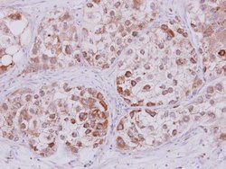 Invitrogen STMN2 Polyclonal Antibody 100 &mu;L; Unconjugated:Antibodies,