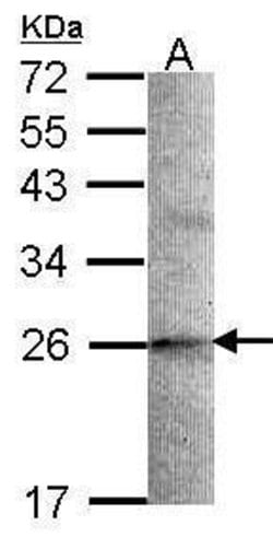 Invitrogen STMN2 Polyclonal Antibody 100 &mu;L; Unconjugated:Antibodies,