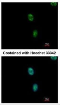 Invitrogen SAP130 Polyclonal Antibody 100 &mu;L; Unconjugated:Antibodies,