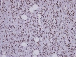 Invitrogen SAP130 Polyclonal Antibody 100 &mu;L; Unconjugated:Antibodies,