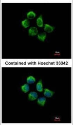 Invitrogen SNX12 Polyclonal Antibody 100 &mu;L; Unconjugated:Antibodies,
