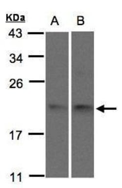 Invitrogen SNX12 Polyclonal Antibody 100 &mu;L; Unconjugated:Antibodies,