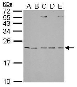 Invitrogen IL1RA Polyclonal Antibody 100 &mu;L; Unconjugated:Antibodies,