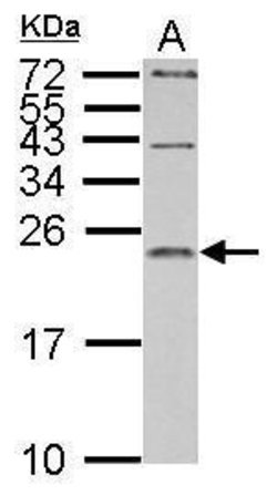 Invitrogen IL1RA Polyclonal Antibody 100 &mu;L; Unconjugated:Antibodies,