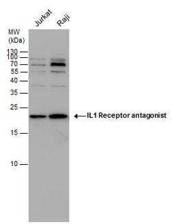 Invitrogen IL1RA Polyclonal Antibody 100 &mu;L; Unconjugated:Antibodies,