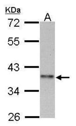 Invitrogen Cyclin I2 Polyclonal Antibody 100 &mu;L; Unconjugated:Antibodies,