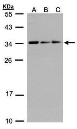 Invitrogen SARNP Polyclonal Antibody 100 &mu;L; Unconjugated:Antibodies,