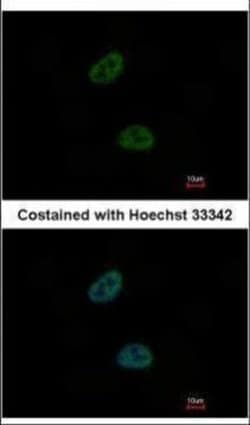 Invitrogen TWA1 Polyclonal Antibody 100 &mu;L; Unconjugated:Antibodies,