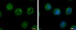 Invitrogen CHMP5 Polyclonal Antibody 100 &mu;L; Unconjugated:Antibodies,