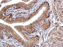 Invitrogen CHMP5 Polyclonal Antibody 100 &mu;L; Unconjugated:Antibodies,