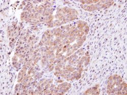Invitrogen CHMP5 Polyclonal Antibody 100 &mu;L; Unconjugated:Antibodies,