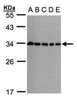 Invitrogen CHMP5 Polyclonal Antibody 100 &mu;L; Unconjugated:Antibodies,