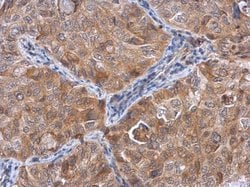 Invitrogen Actin-like 8 Polyclonal Antibody 100 &mu;L; Unconjugated:Antibodies,