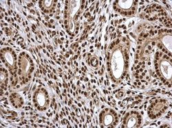 PSME3 Polyclonal Antibody, Invitrogen 100 &mu;L; Unconjugated:Antibodies,